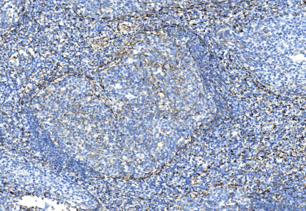 14 - Caldesmon AD80175
