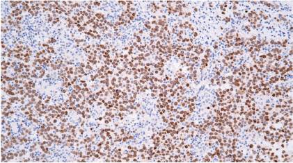 14 - Anti-SALL4 antibody AD80188