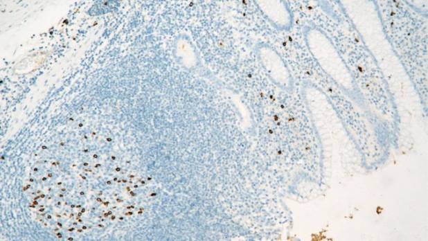 14 - IgG4 AD80197