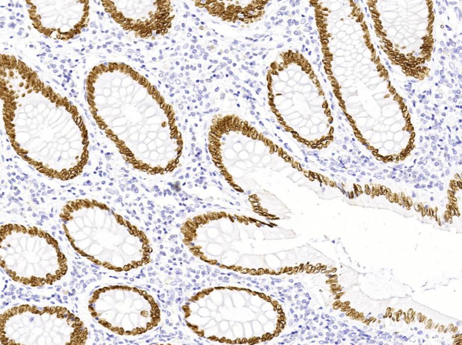 14 - Anti-SATB2 antibody AD80202