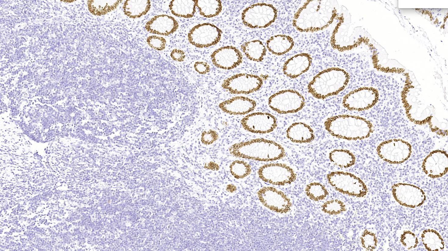 14 - Anti-SATB2 antibody AD80202