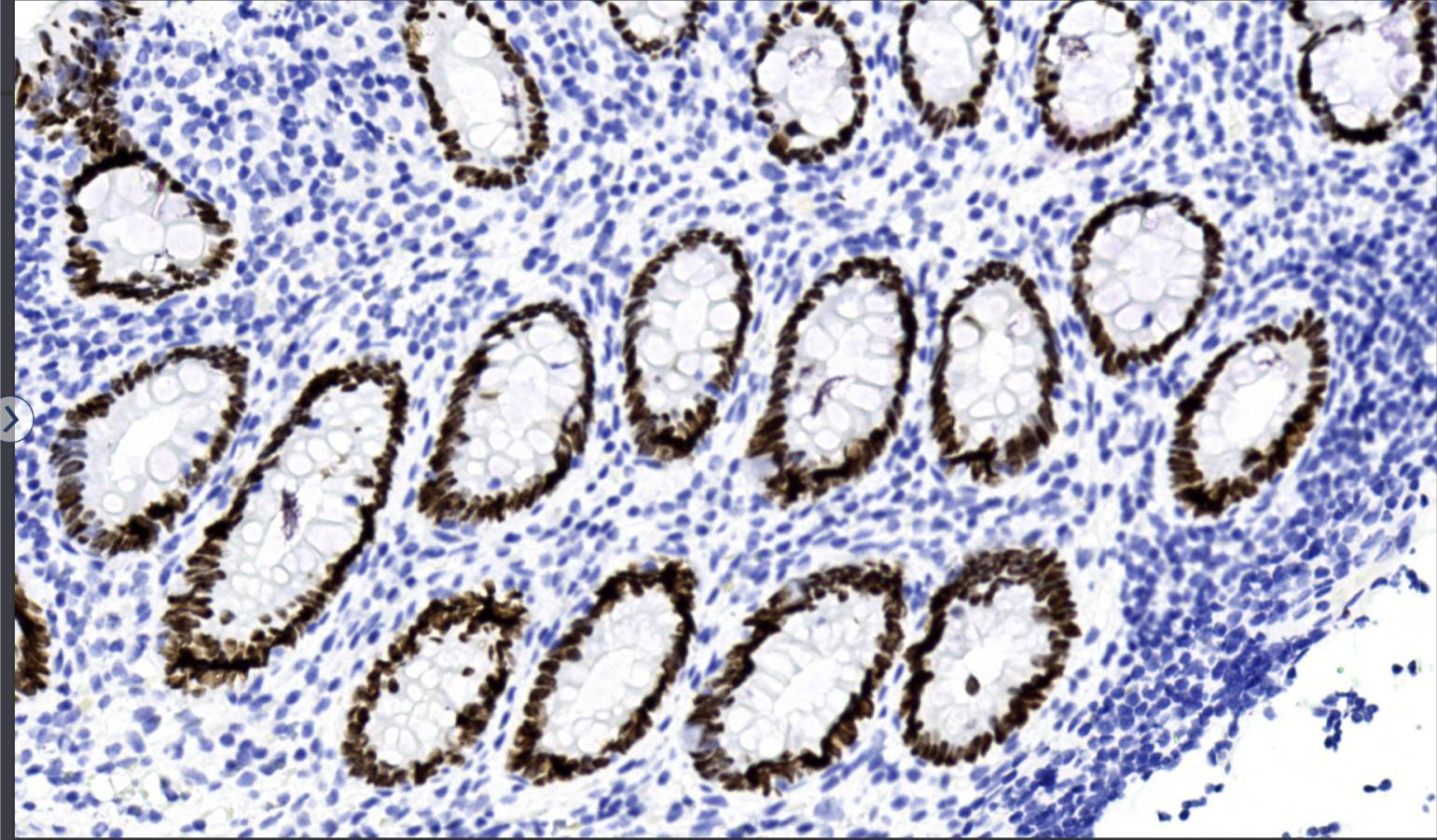 14 - Anti-SATB2 antibody AD80202