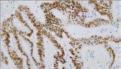 14 - Anti-SATB2 antibody AD80202