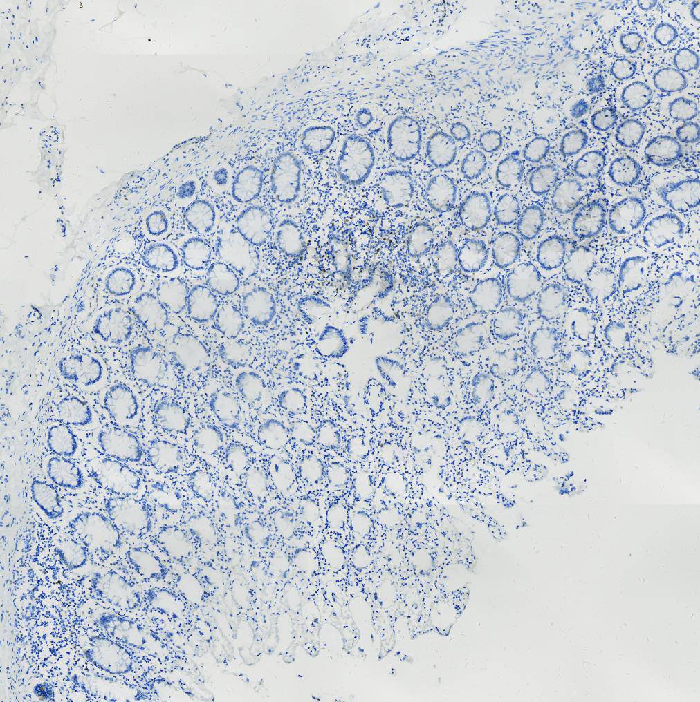 14 - TFE3 AD80203