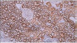 14 - Anti-STAT6 antibody AD80204