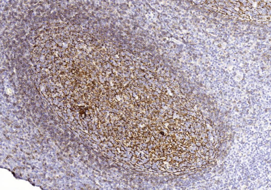14 - CD21 AD80208