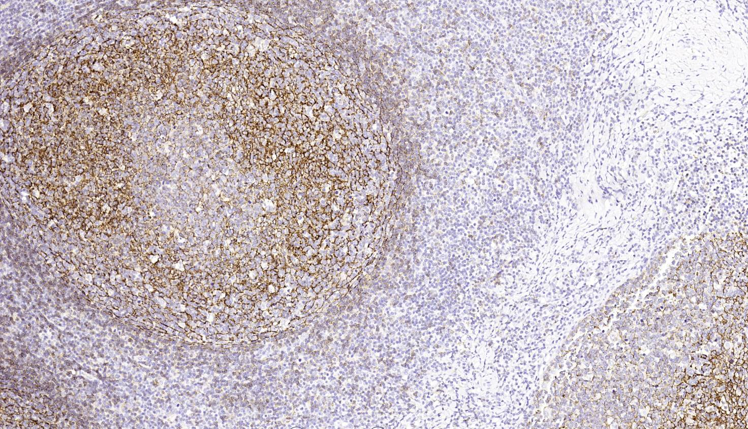 14 - CD21 AD80208