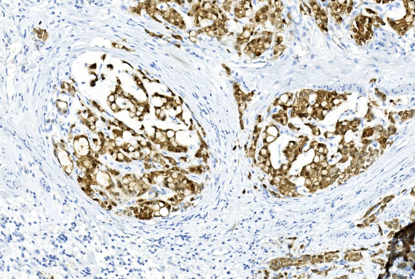 14 - Villin AD80209
