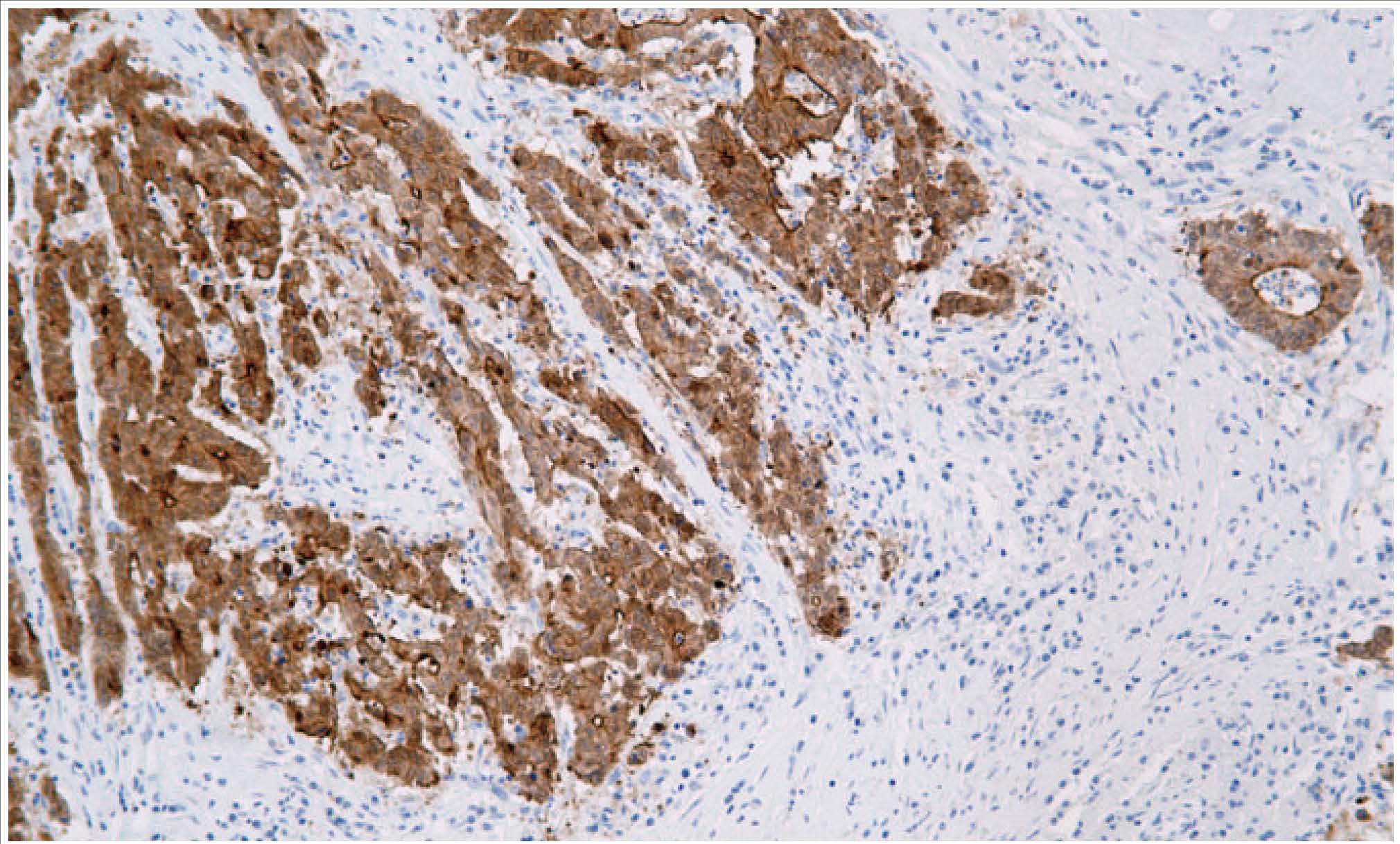 14 - Villin AD80209