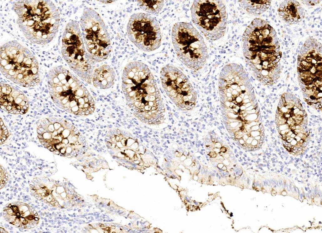 14 - EMA AD80210