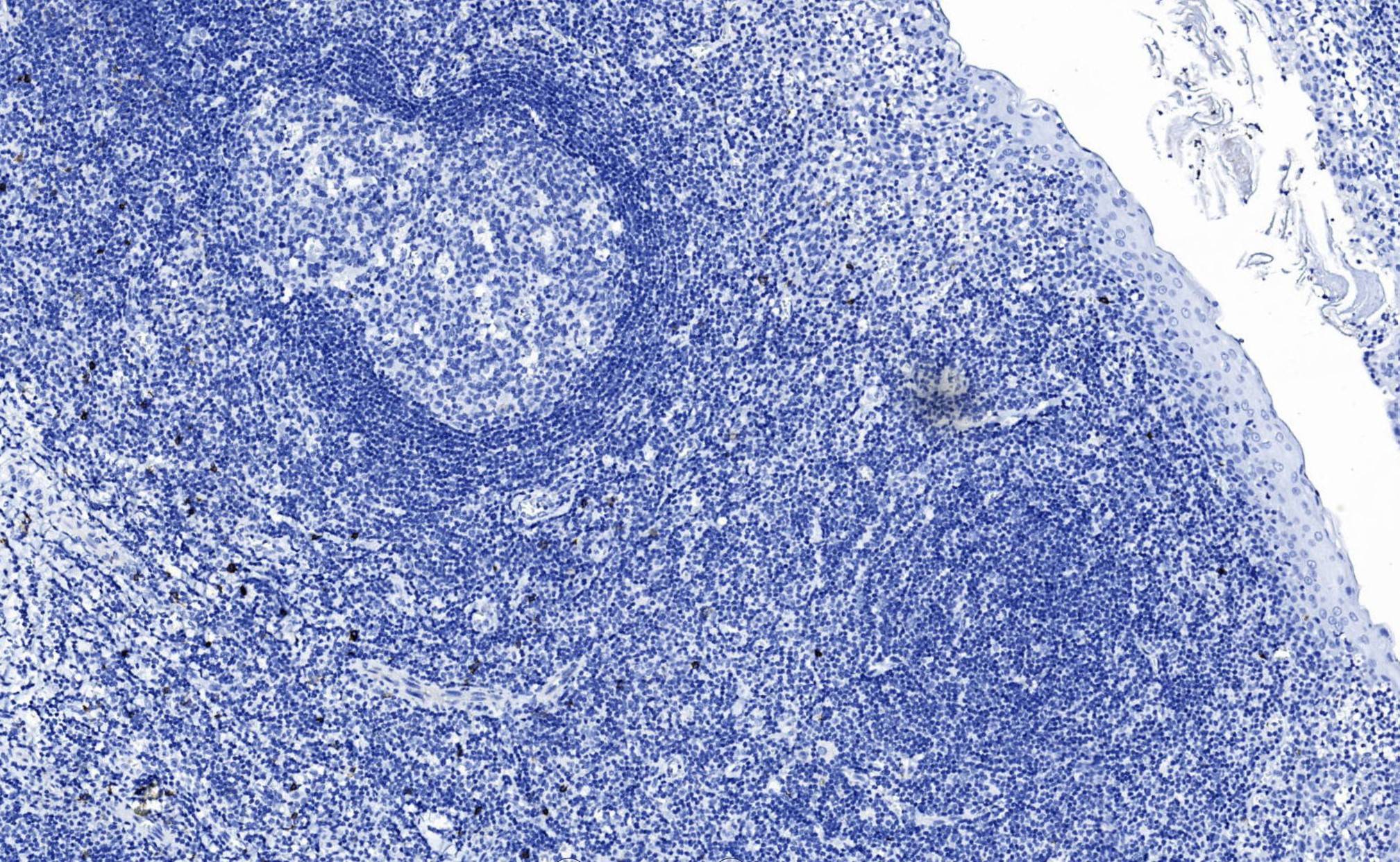 14 - CD56 AD80211