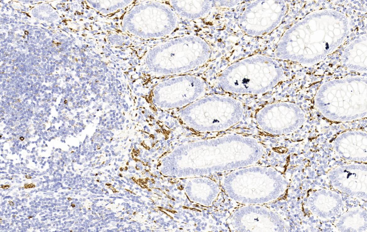 14 - CD56 AD80211