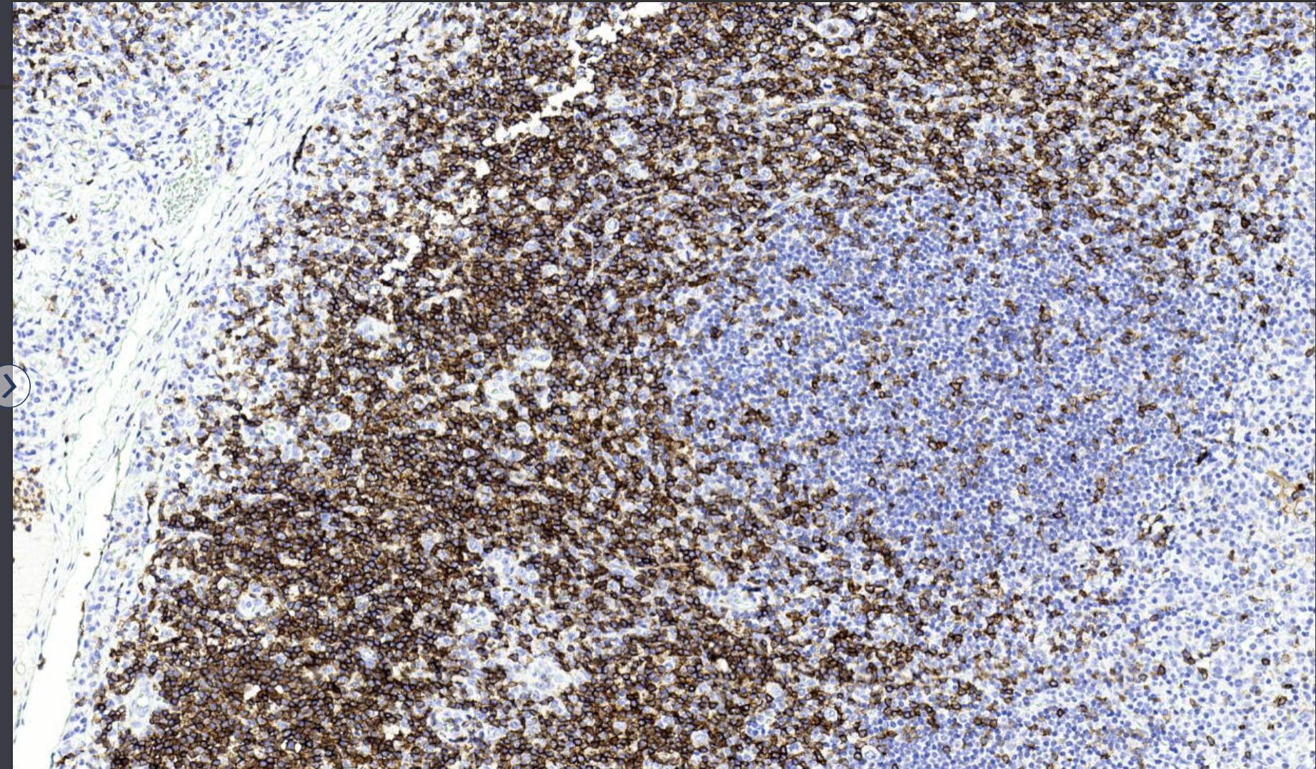 14 - CD5 AD80221