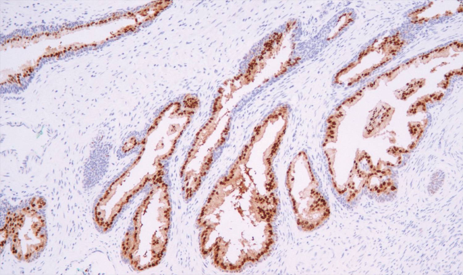 14 - NKX3.1 AD80224