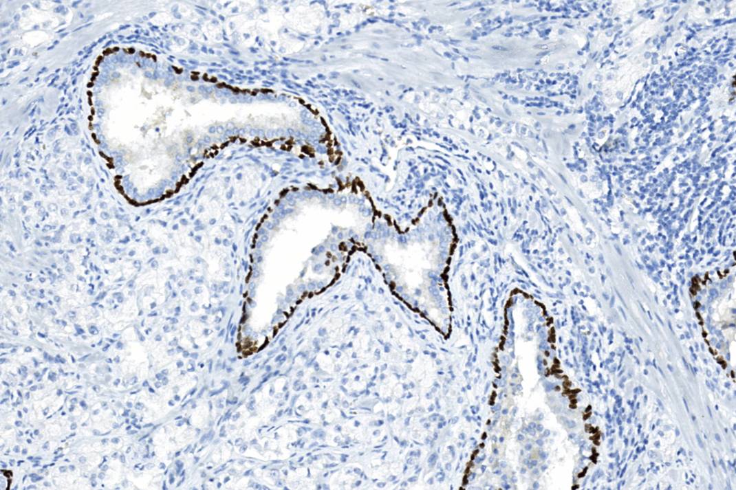 14 - p40 Antibody AD80229