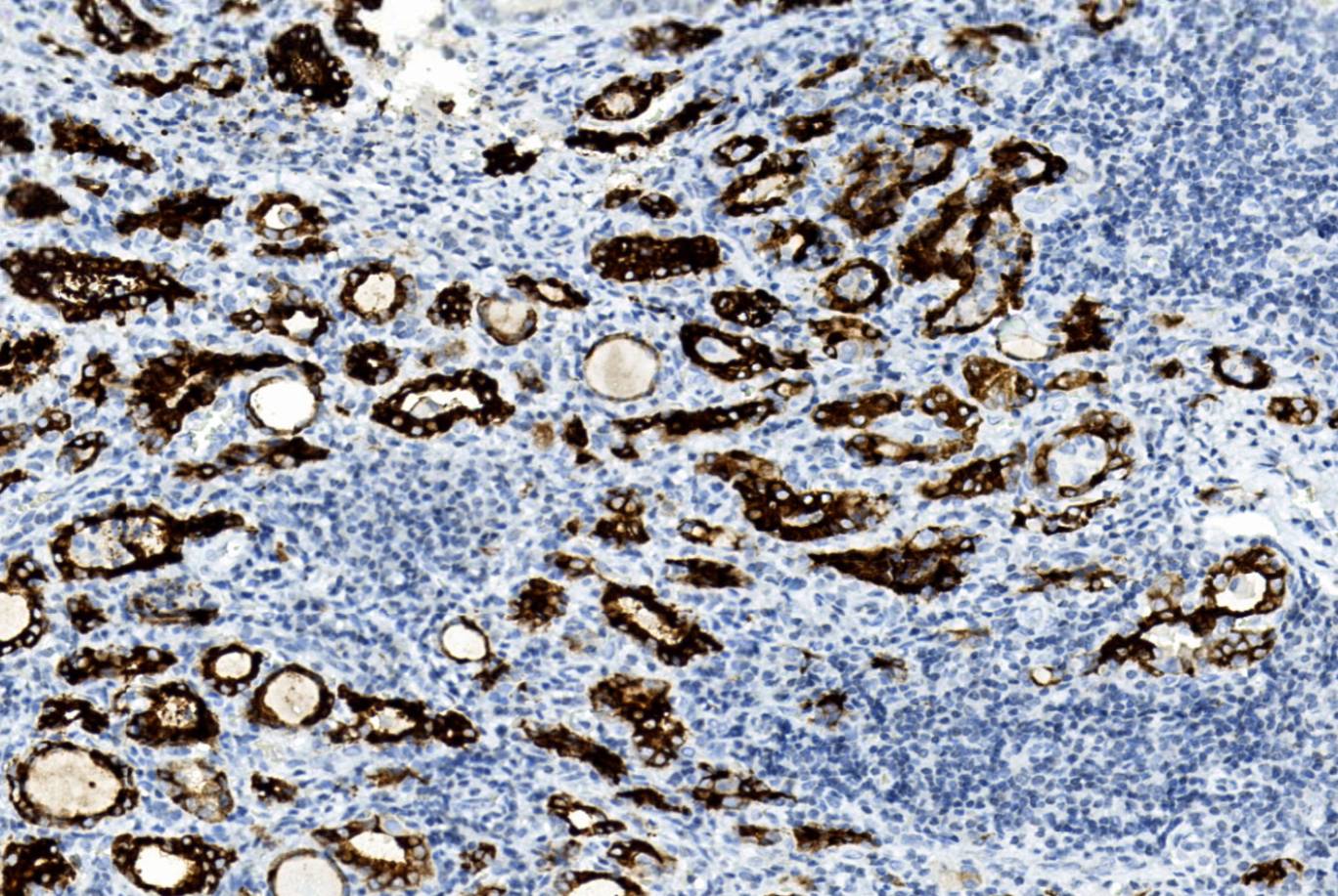 14 - TPO AD80232