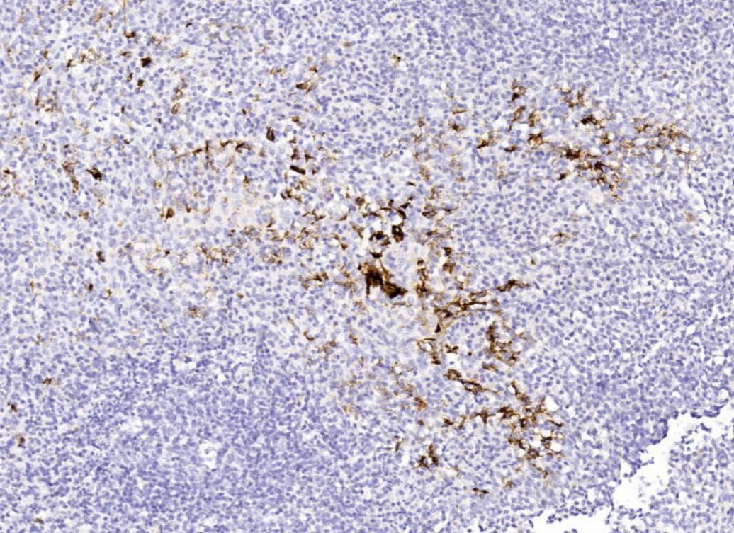 14 - CA 125 AD80233