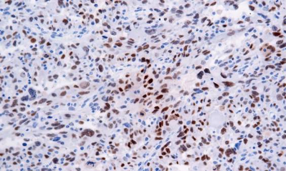 14 - Myo D1 AD80240