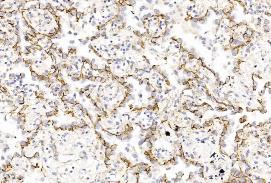 14 - p120 AD80241