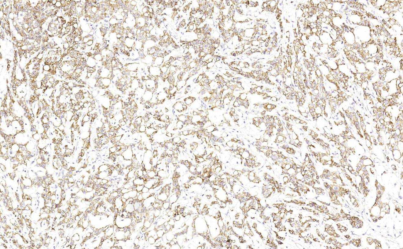 14 - p120 AD80241