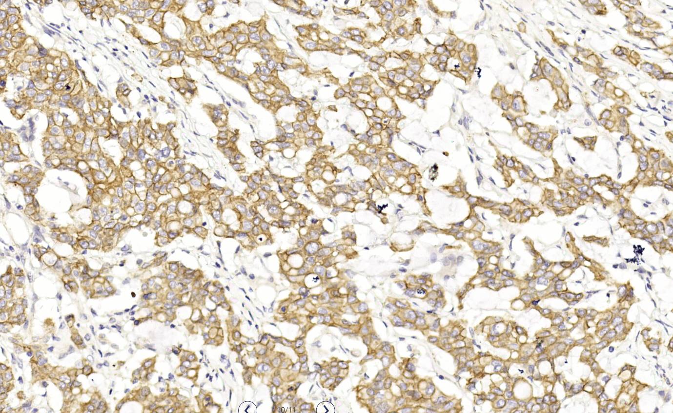 14 - p120 AD80241