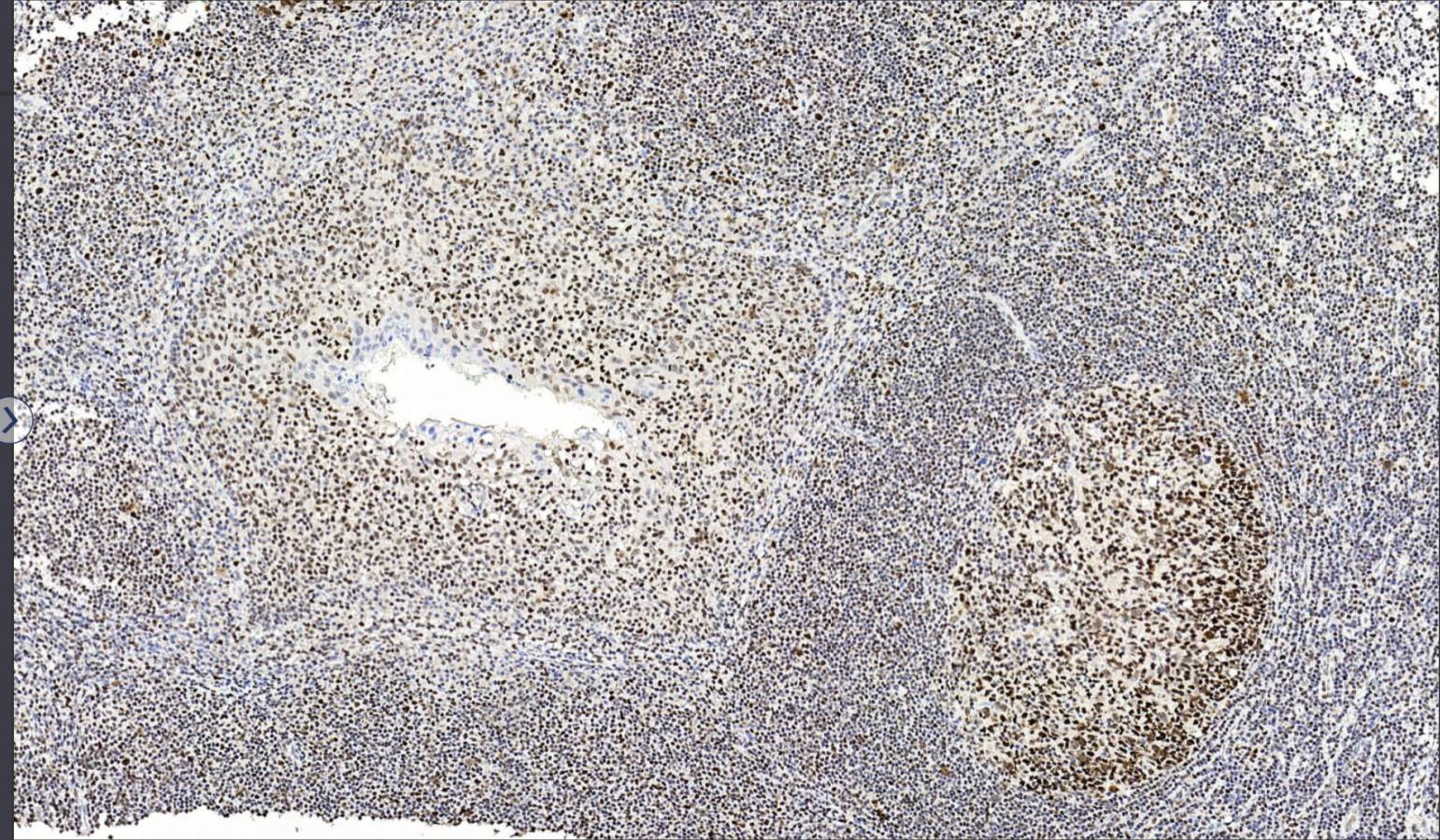 14 - PMS2 AD80243