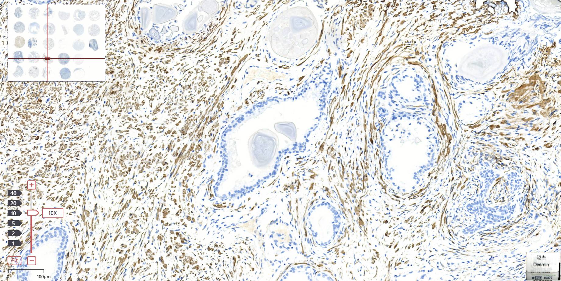 14 - Desmin Antibody AD80245