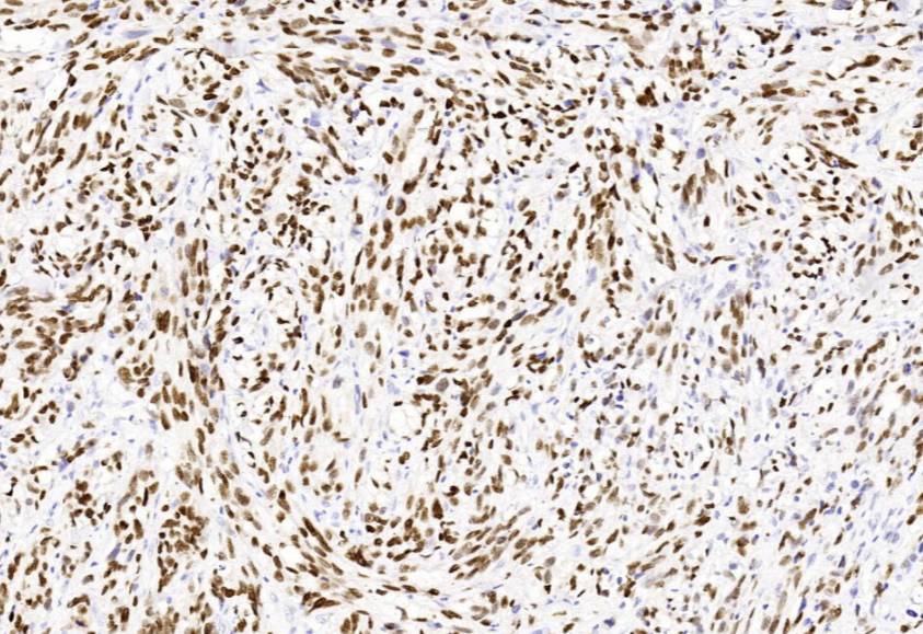 14 - Anti-SOX-10 antibody AD80247
