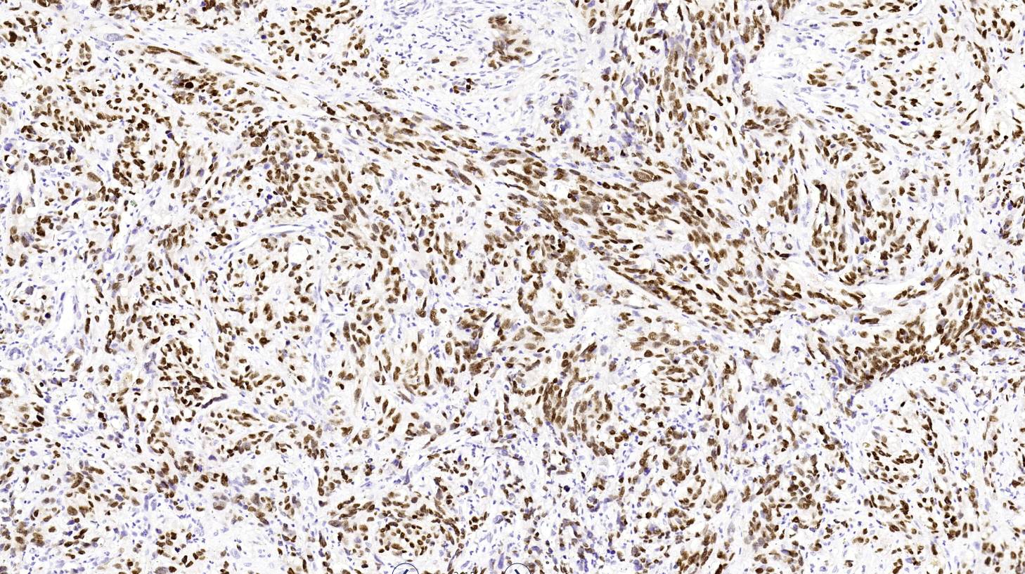 14 - Anti-SOX-10 antibody AD80247