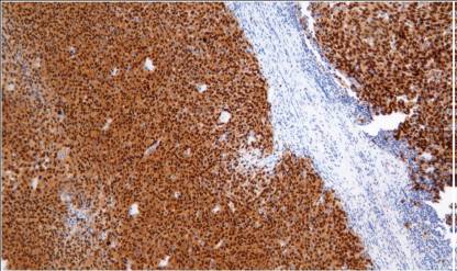 14 - Anti-SOX-10 antibody AD80247