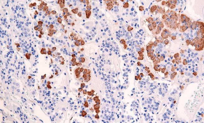 14 - ACTH AD80249