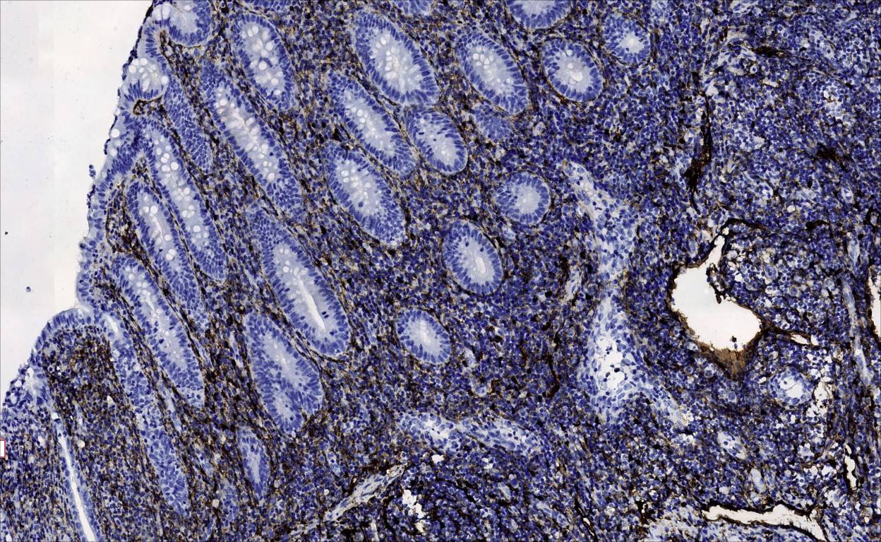 14 - D2-40 AD80252