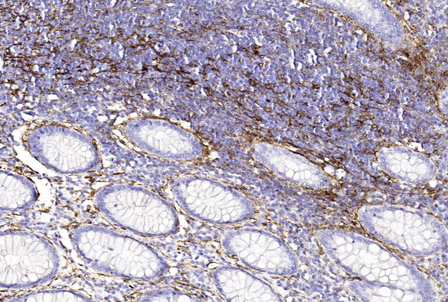 14 - D2-40 AD80252