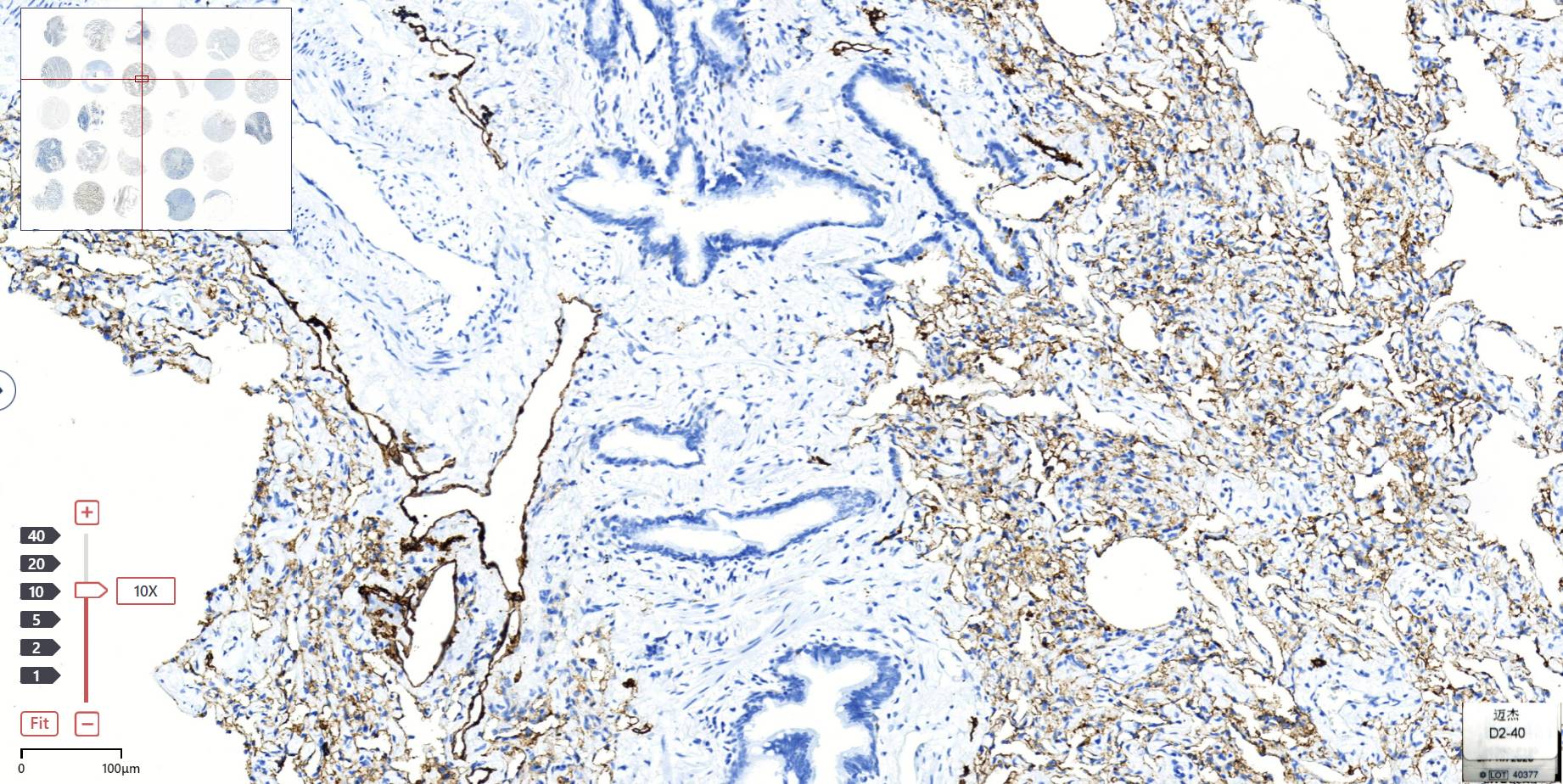 14 - D2-40 AD80252