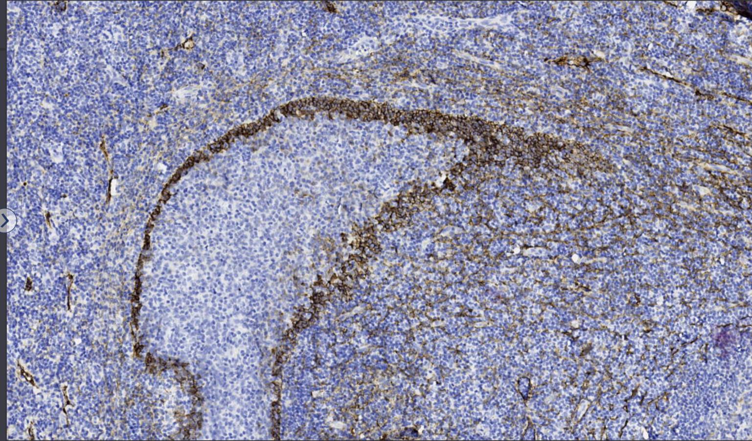 14 - D2-40 AD80252