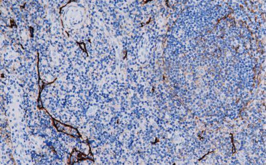 14 - D2-40 AD80252