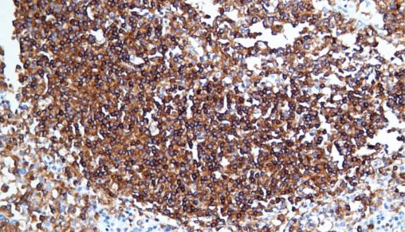 14 - HLA-DR AD80254