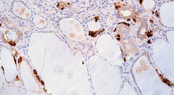 14 - Calcitonin AD80258