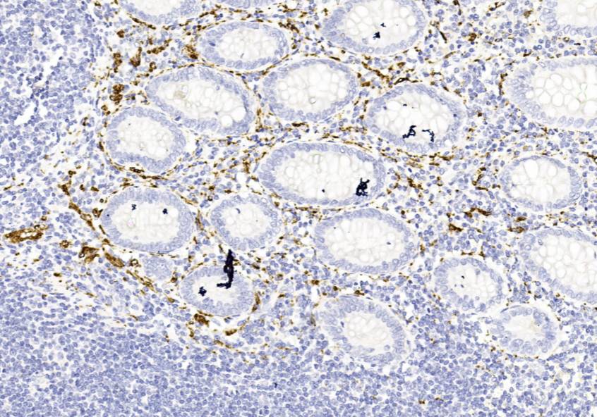 14 - Calretinin AD80262
