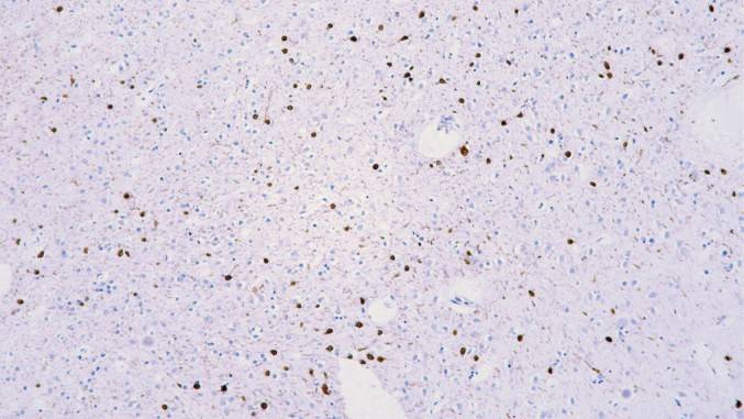 14 - Calretinin AD80262