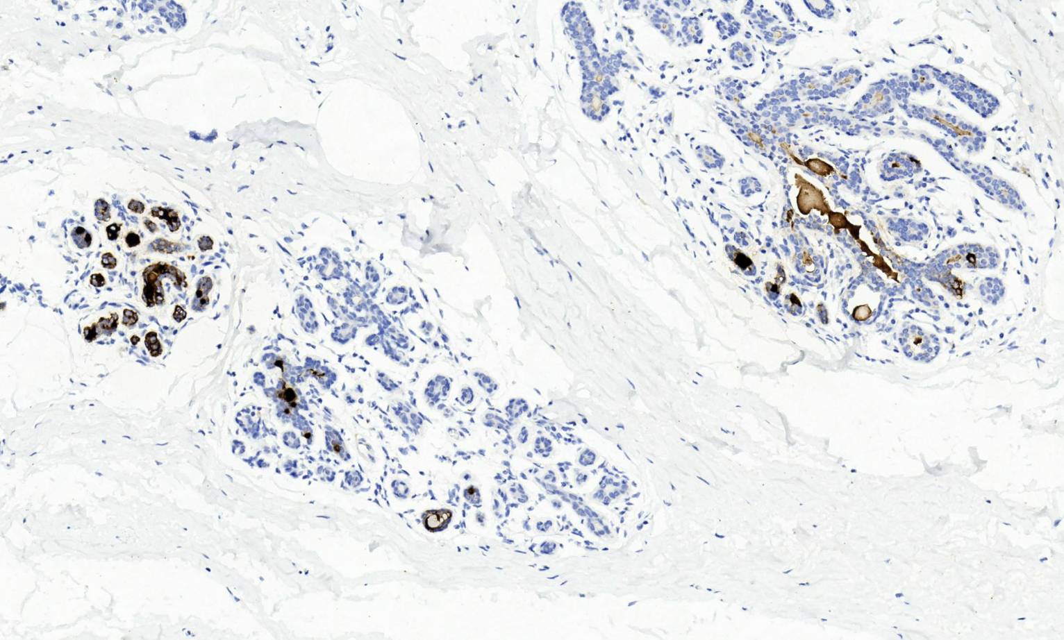 14 - GCDFP-15 AD80264