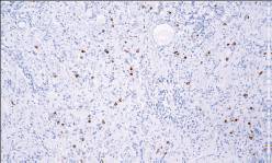 14 - Somatostatin AD80270