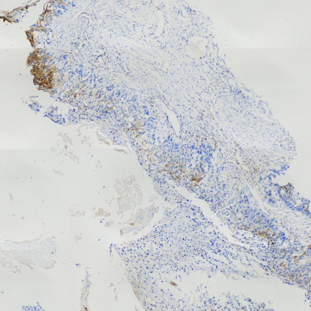 14 - TGF-β1 Antibody AD80272
