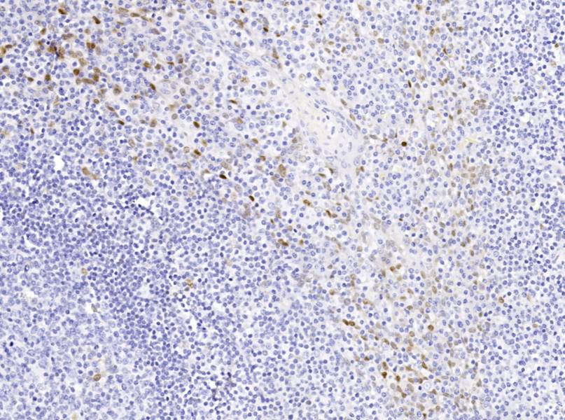 14 - Cyclin D1 AD80273
