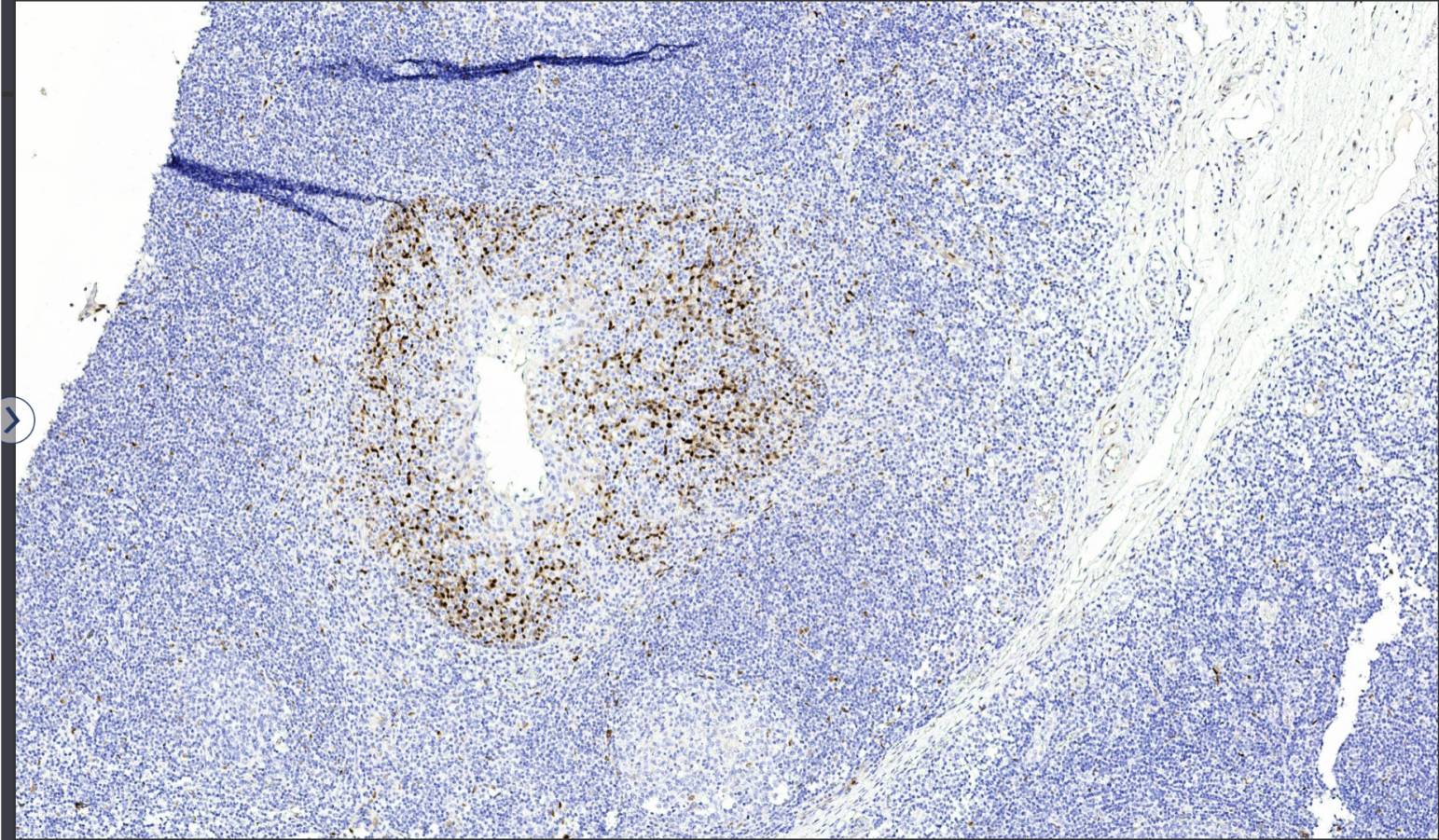 14 - Cyclin D1 AD80273