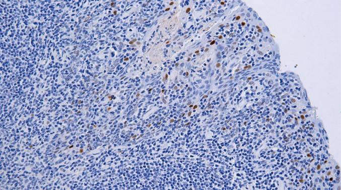 14 - Cyclin D1 AD80273