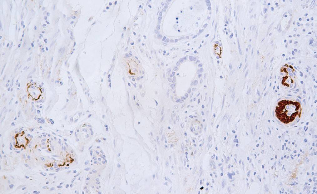 14 - C4d AD80279