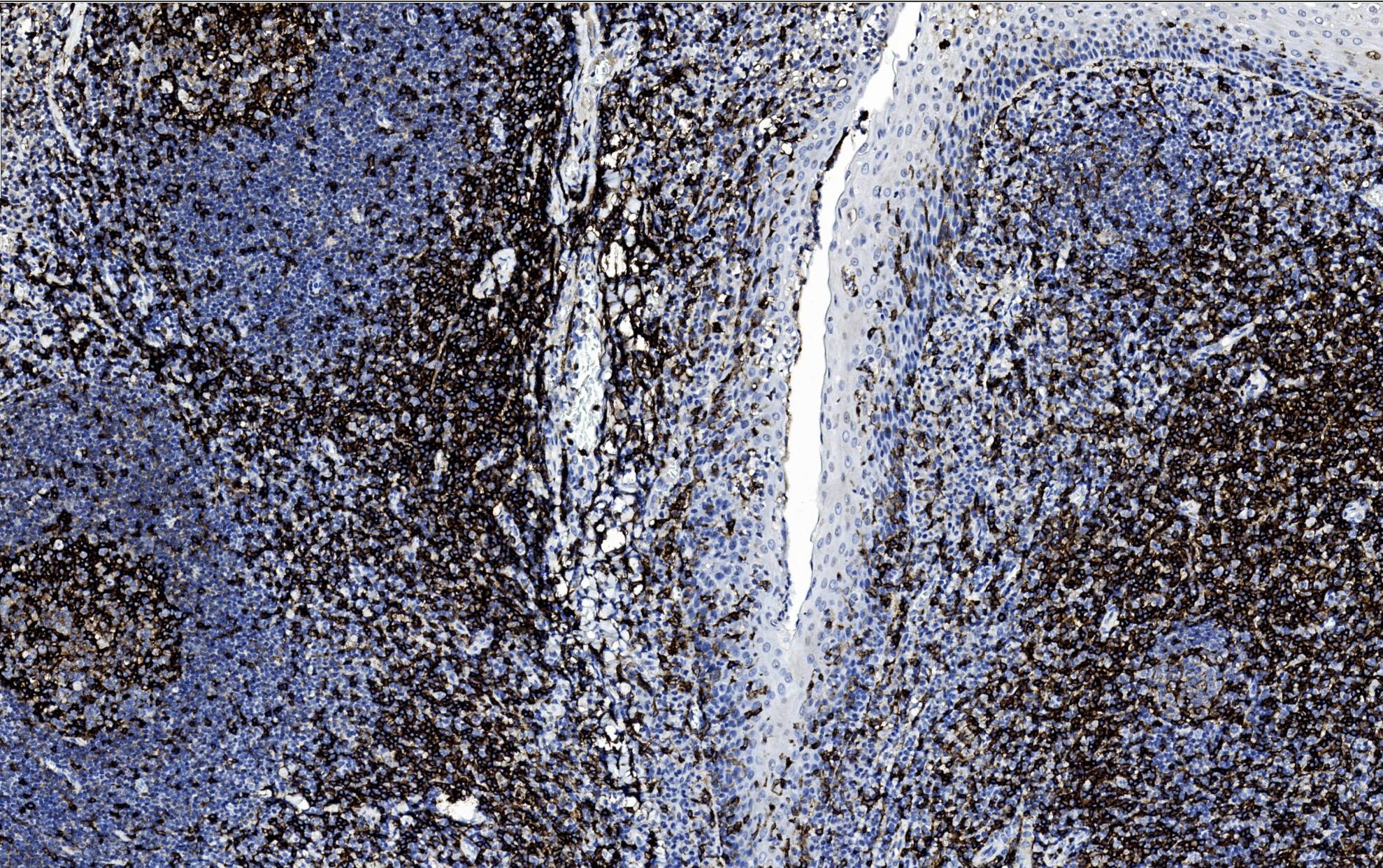 14 - Anti-CD4 antibody AD80285