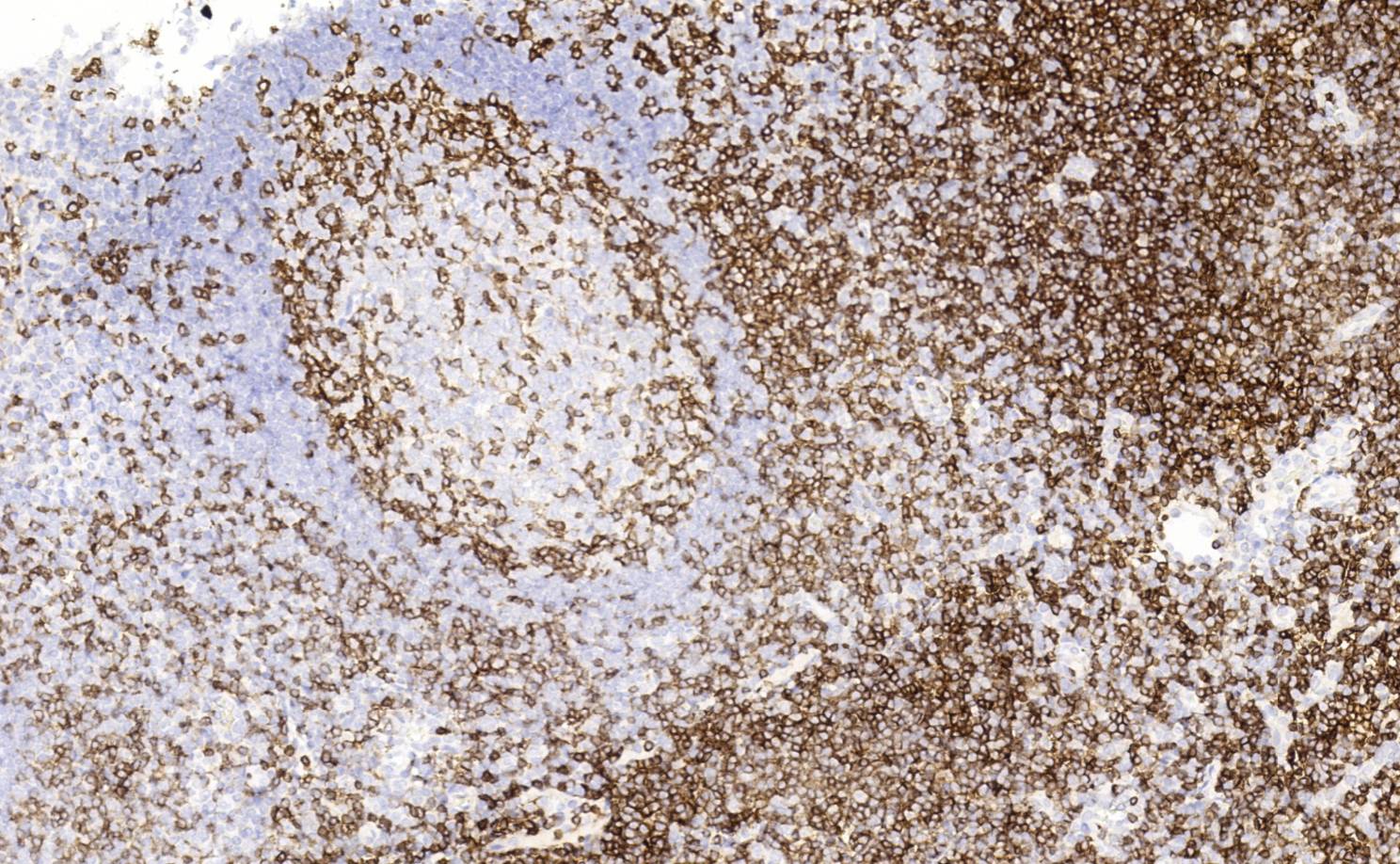 14 - Anti-CD4 antibody AD80285