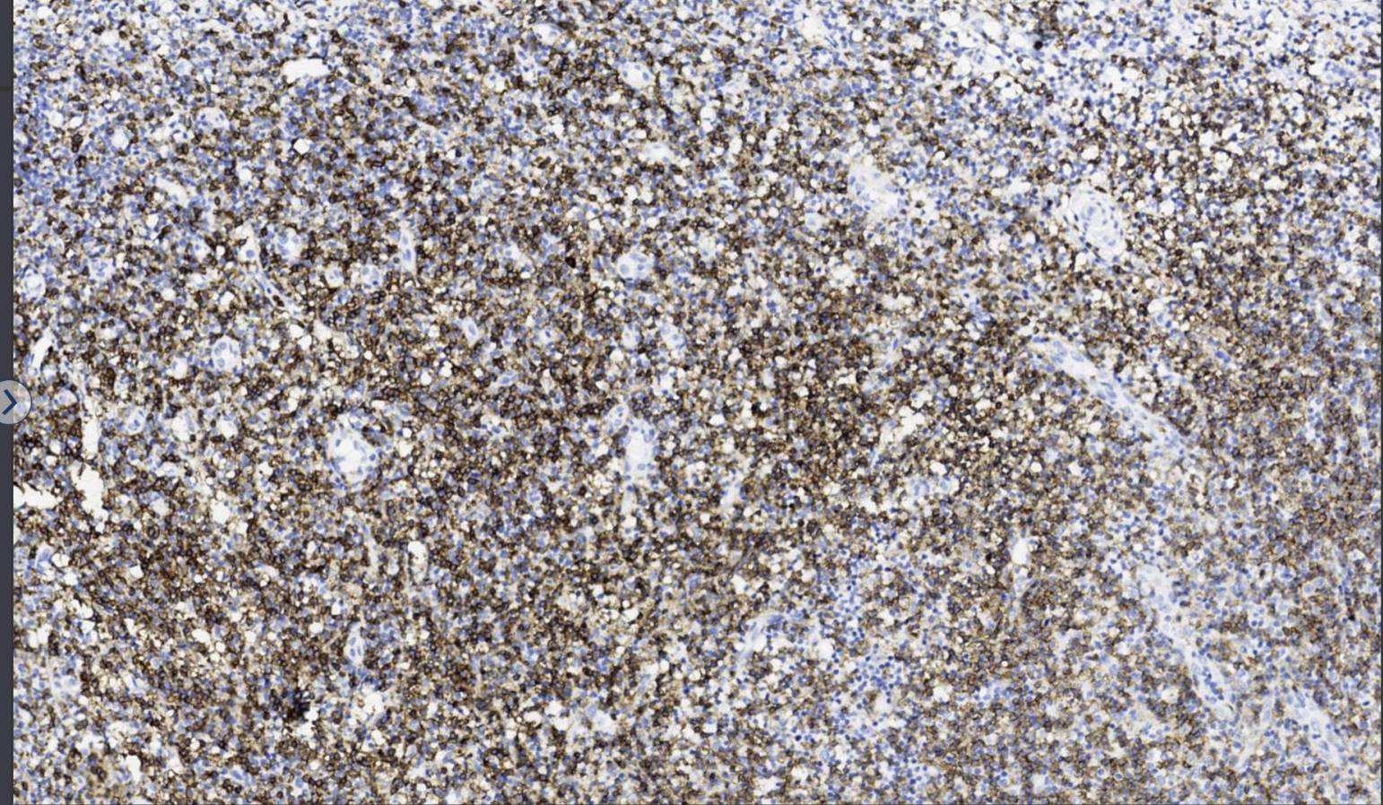 14 - Anti-CD4 antibody AD80285